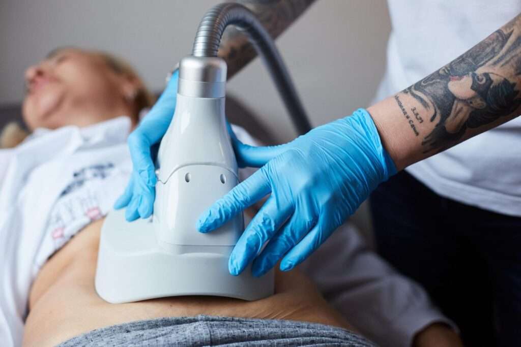 Fettreduktion ohne OP Behandlung im kosmetikstudio in Baden